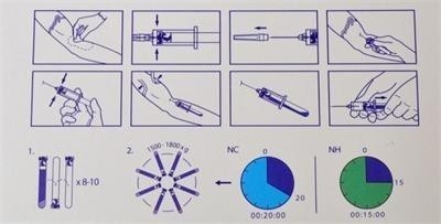 6/8x15ml Φορητή συσκευή φυγοκέντρωσης PRP 0-4000rpm Για νοσοκομεία αισθητικής χειρουργικής